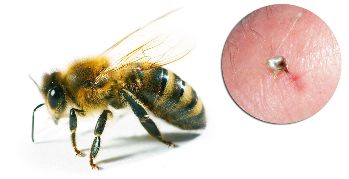 Parte Hondrostrong incluyen el veneno de la abeja, lo que mejora los procesos metabólicos en los tejidos