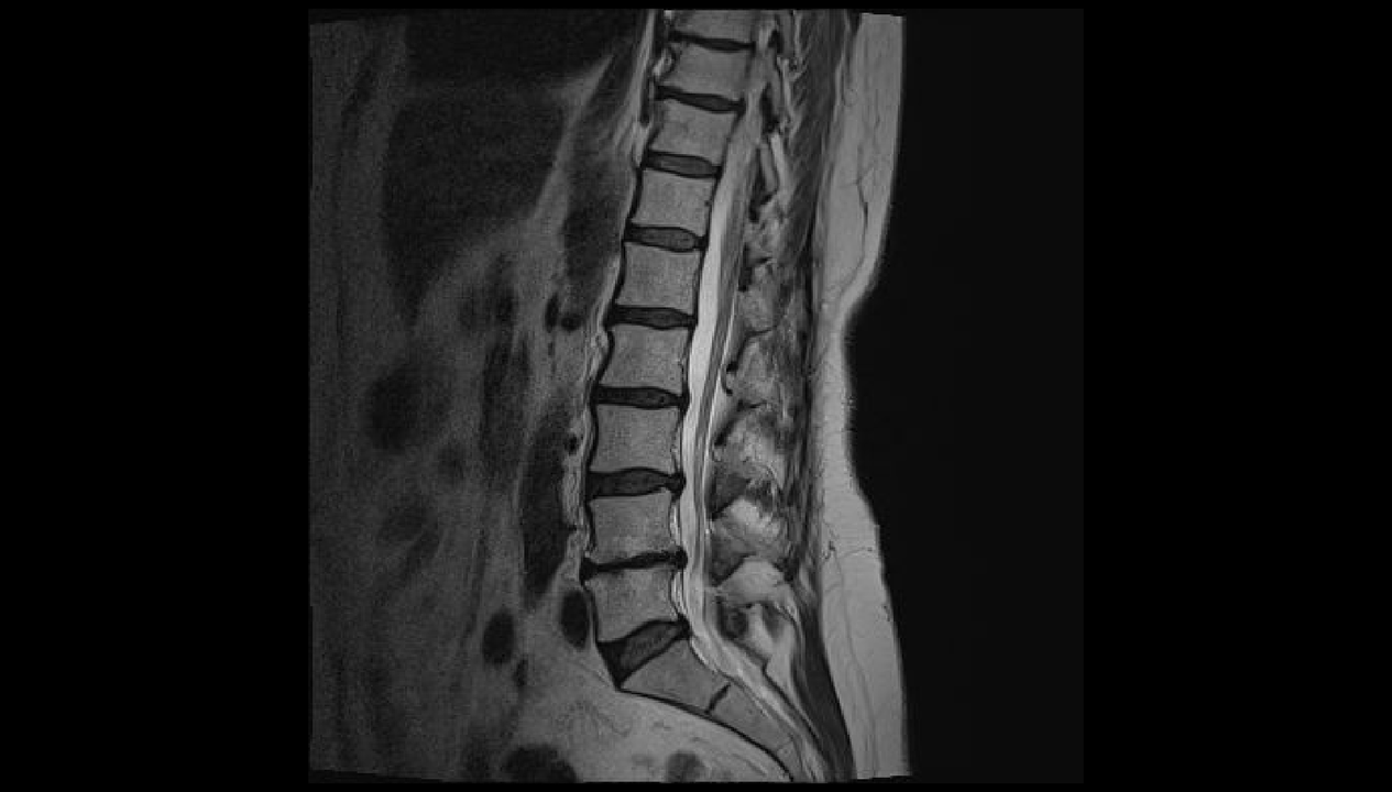 Diagnosticar el dolor de espalda en la región lumbar. 