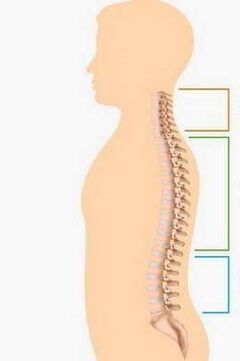 Derrota debido a la osteocondrosis de varias partes de la columna. 